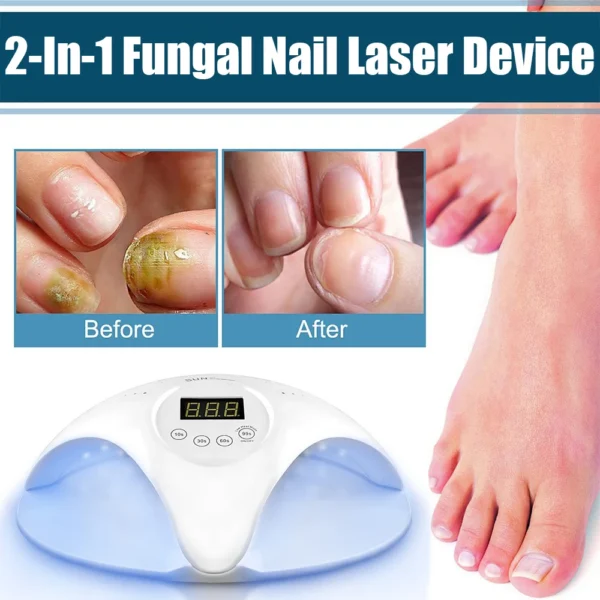 Electric Fungal Nail Laser Device Repair Fast Nails Fungus Onychomycosis Repair Toenail Fingernail Removes Nail Fungus Foot Care - Image 6