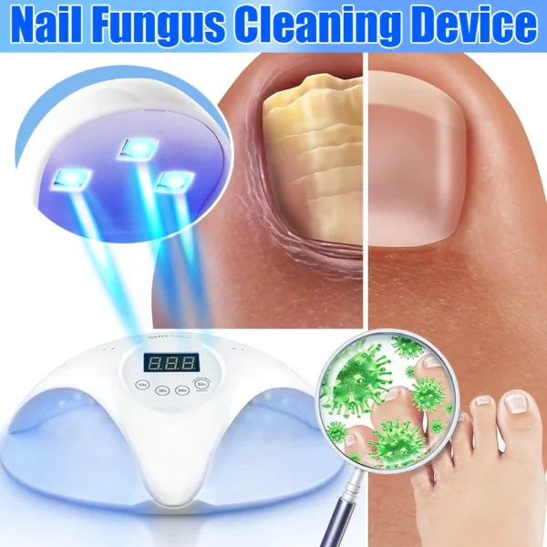 Electric Fungal Nail Laser Device Repair Fast Nails Fungus Onychomycosis Repair Toenail Fingernail Removes Nail Fungus Foot Care - Image 5